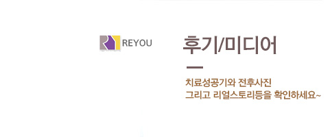 ���� ġ���ı�