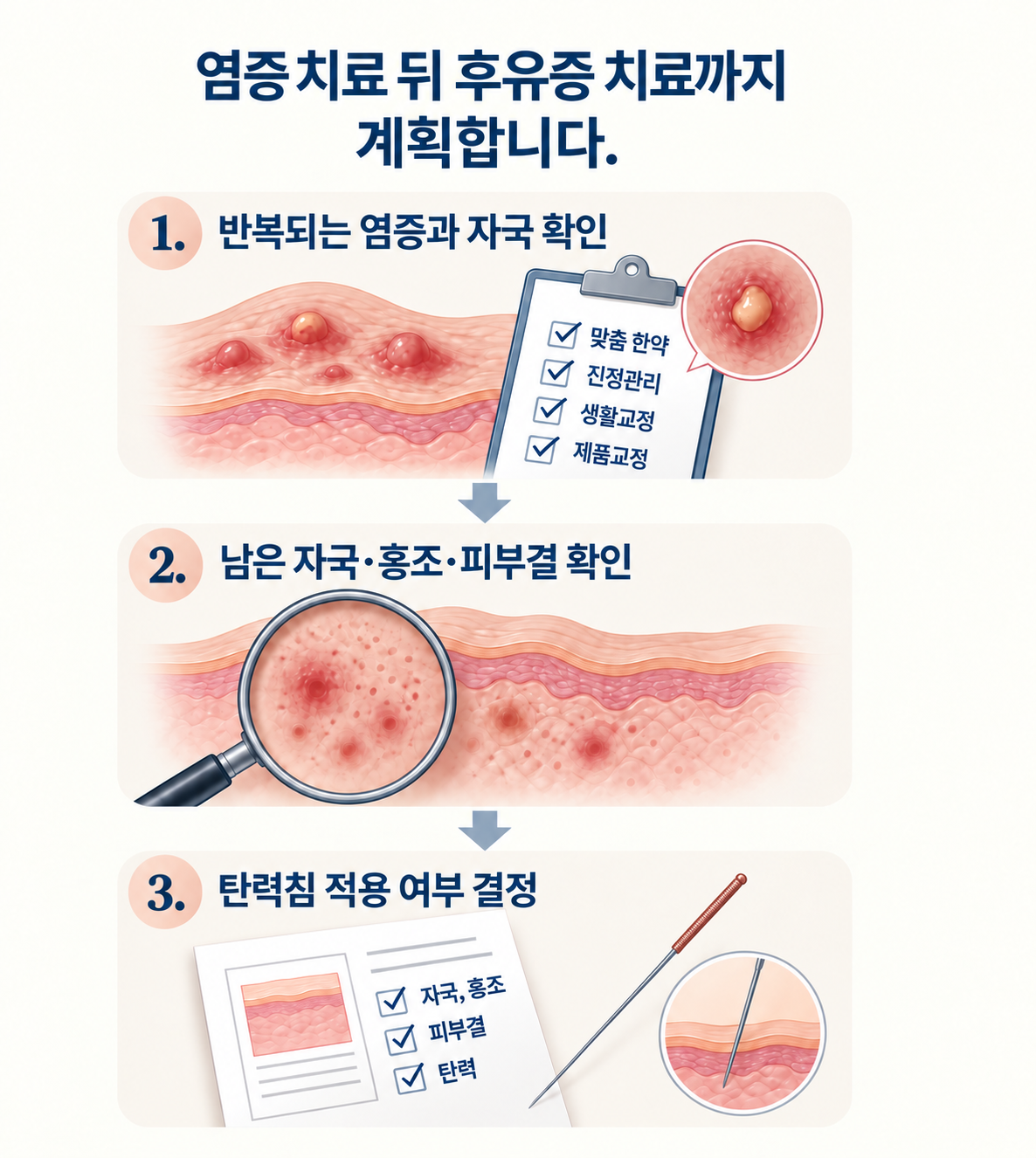 염증 치료와 후유증 치료 순서